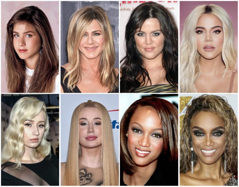 18 Celebrities Who Don’t Hide It That They’ve Had Plastic Surgery