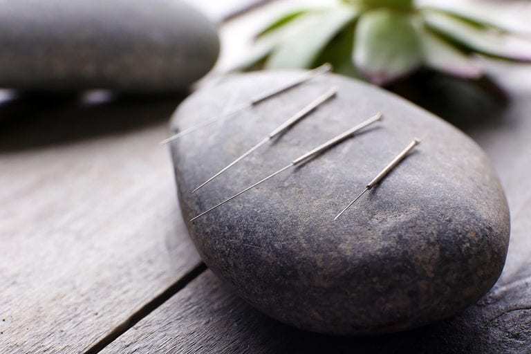 Celebrities Love Acupuncture: Should You Try It, Too? - The Frisky