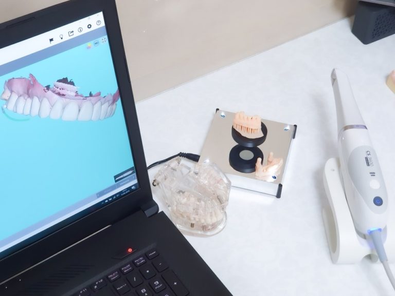 The new trend of teeth cloning is gaining momentum The Frisky