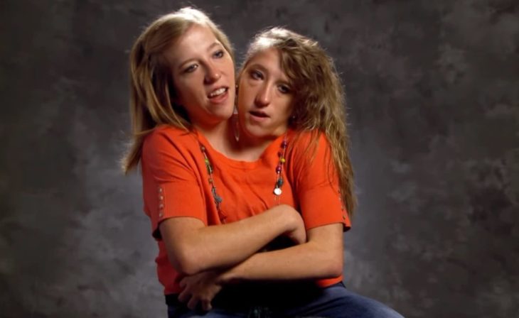 PRO TV - Povestea gemenelor siameze Abigail și Brittany Hensel. Cum arată viața lor la 31 de ani