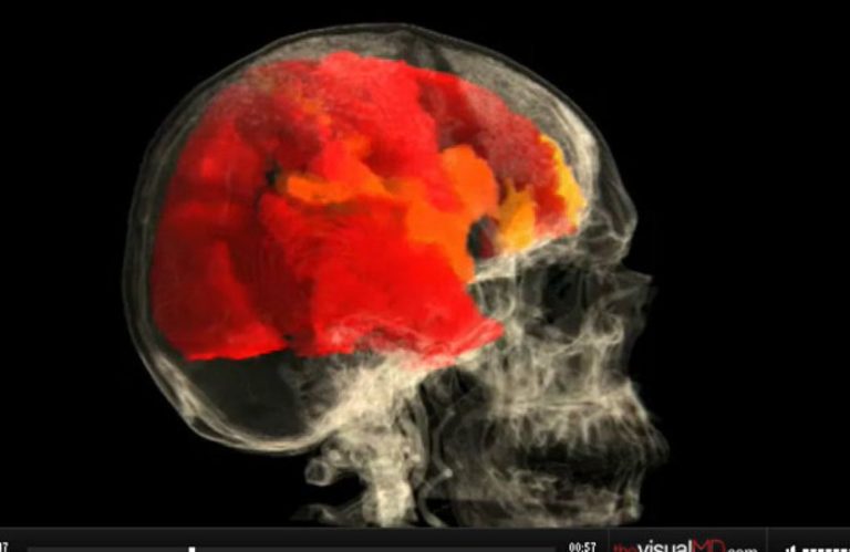 This Is What Your Brain Looks Like During An Orgasm The Frisky