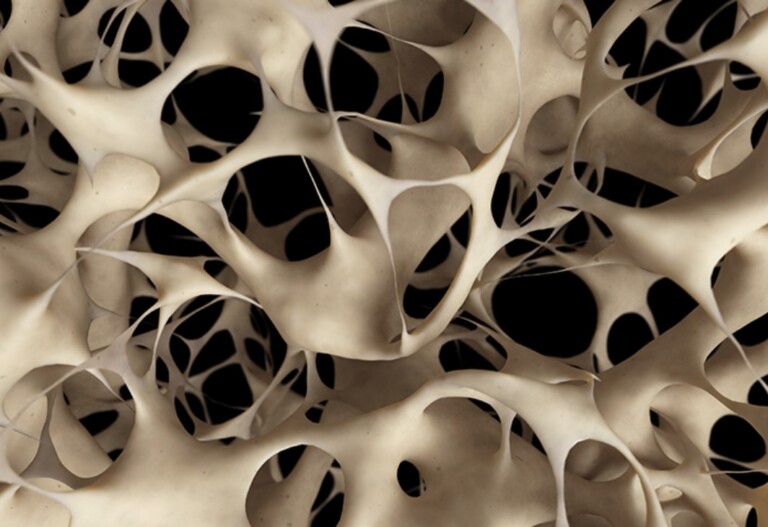 What is Wolff’s Law and How is it Related to Posture and