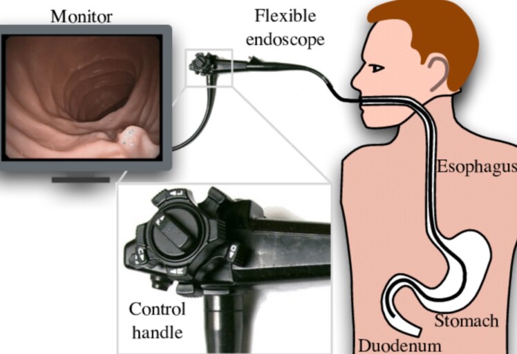 what-is-the-difference-between-borescopes-and-endoscopes-the-frisky