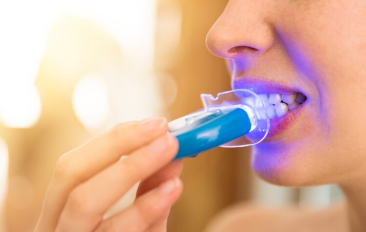 5 Teeth Whitening Methods that You Should Know