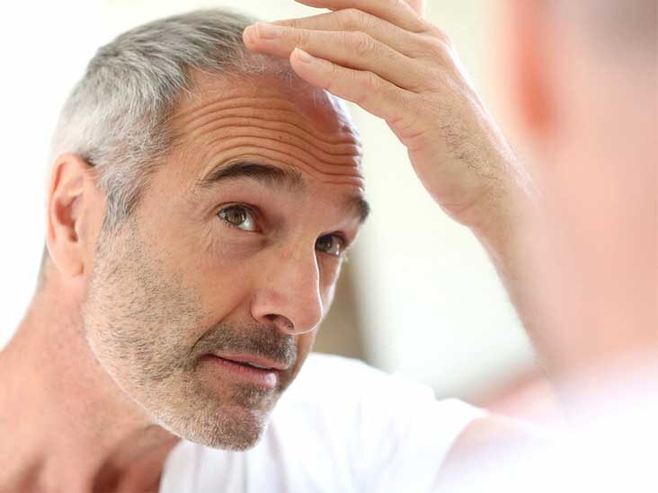 best hair loss treatments