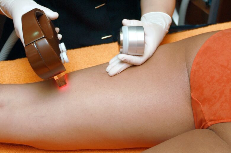 Langley Laser Hair Removal Clinic Reviews - Get Permanent Hair Removal in  Langley, BC - The Frisky