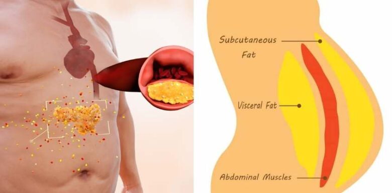 Is Visceral Fat Dangerous How To Get Rid Of It The Frisky 1081