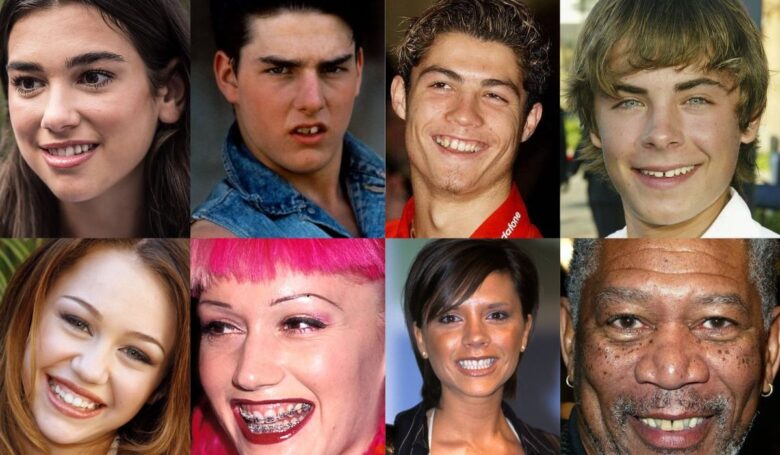 20 Most Stunning Celebrity Smile Transformations That Prove Cosmetic Dentistry Is Worth It
